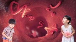 Cacingan Pada Anak : Ini Gejala, Bahaya, Dan Cara Mengatasinya